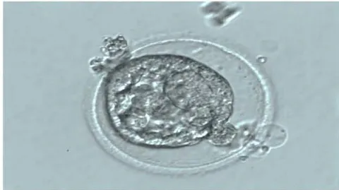 Fig. 1: Human embryo of the 5th day of development, the stage of the collapsed human blastocyst, immediately after defrosting. Boost: x200.