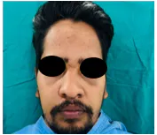 Group B - Subfigure 2