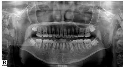 Figure 13: Post-Treatment Lateral Cephalometric and Panoramic Radiographs