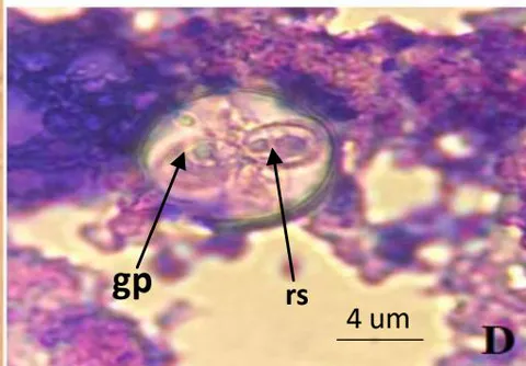 Figure 4: Light microscopy of Eimeria sp. oocysts found in Mugil cephalus