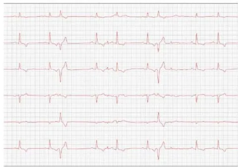 Figure 3: Electrocardiogram (2022)