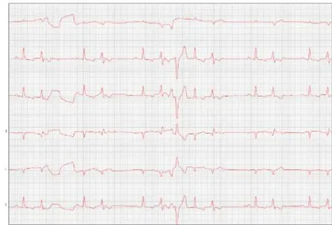 Figure 7: Electrocardiogram (September/2023)