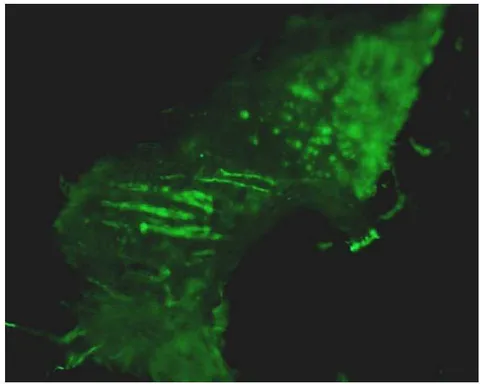 Figure 5: Green, fluorescent periosteal Sharpey's fibres approximately 10 microns thick, rich in collagen Type III and extending from the periosteum, traversing the bone matrix and shown in longitudinal and cross section. Fluorescein isothiocyanate immunostain, cryomicrotomy, epifluorescence microscopy[36].