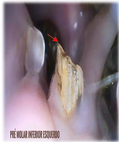 Fig. 4: Desalinhamento oclusal dos incisivos inferiores. Vista Rostral.