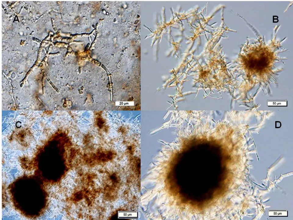 Figure 5: Growth of Hericium erinaceus in submerged cultivation. (A) fungal mycelia (14 h)(magnification 1000x); (B) mycelia clumps (218 h) (400x), (C) mycelia pellets (262 h) (100x), (D) mycelia pellets (346 h) (100x) (Photo M.Vittori)